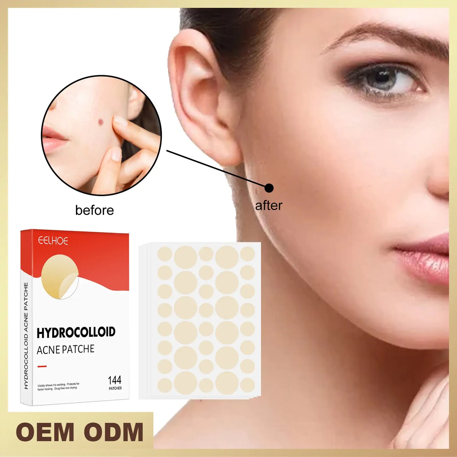 Patch Hero Cosmetics Hydrocolloid Acne Patch