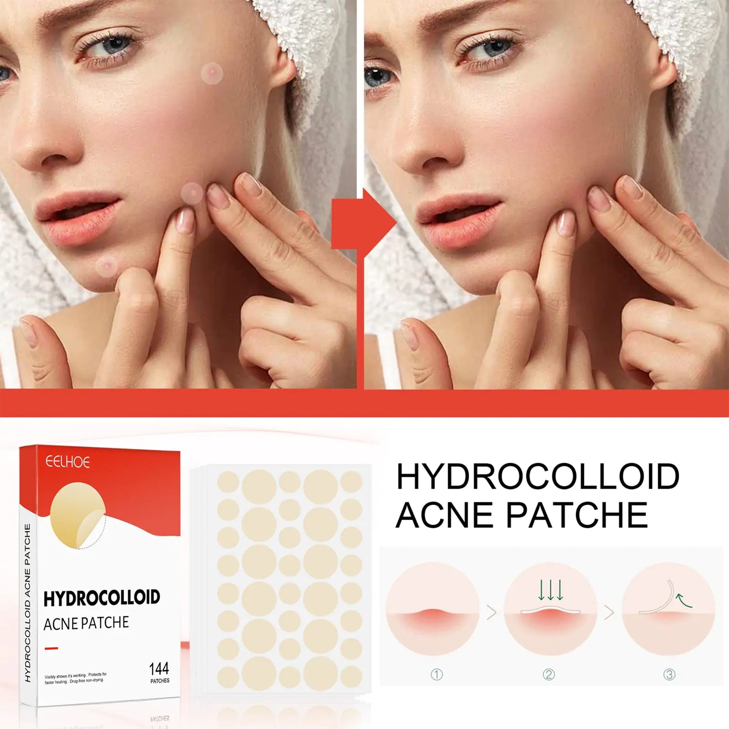 Patch Hero Cosmetics Hydrocolloid Acne Patch